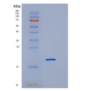 Recombinant Human DSTN Protein