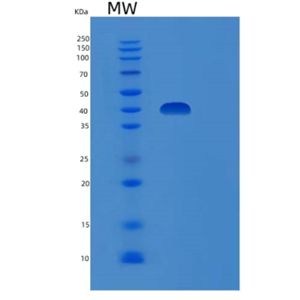 Recombinant Human DUSP6 Protein,Recombinant Human DUSP6 Protein