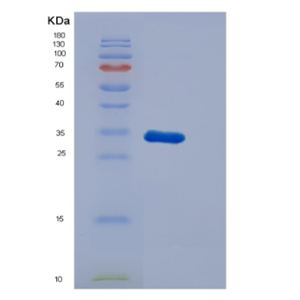 Recombinant Human Dysbindin Protein,Recombinant Human Dysbindin Protein