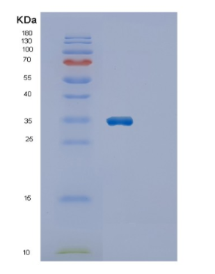 Recombinant Human ECHDC1 Protein,Recombinant Human ECHDC1 Protein