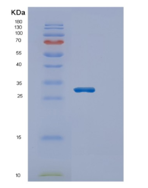 Recombinant Human ECHS1 Protein,Recombinant Human ECHS1 Protein