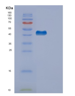 Recombinant Human EDA2R Protein,Recombinant Human EDA2R Protein