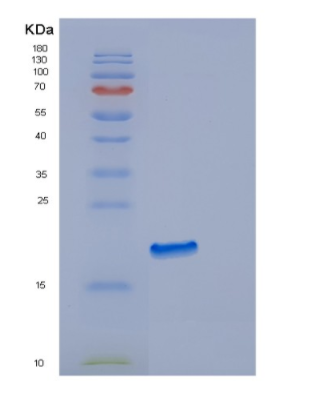 Recombinant Human EDN2 Protein,Recombinant Human EDN2 Protein