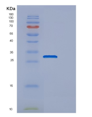 Recombinant Human ECI1 Protein,Recombinant Human ECI1 Protein