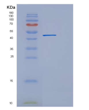 Recombinant E.coli EEF1A1 Protein,Recombinant E.coli EEF1A1 Protein