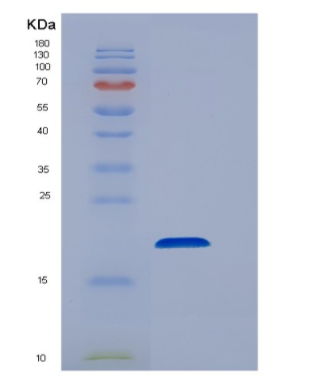 Recombinant Human EEF1E1 Protein,Recombinant Human EEF1E1 Protein