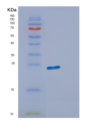 Recombinant Human ECSIT Protein,Recombinant Human TAU Protein