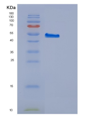 Recombinant Human EED Protein,Recombinant Human EED Protein