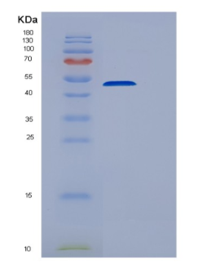 Recombinant Human EEF1G Protein,Recombinant Human EEF1G Protein