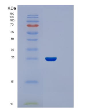 Recombinant E.coli FIMC Protein,Recombinant E.coli FIMC Protein