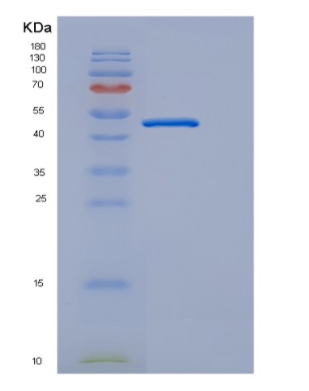 Recombinant Human EDAR Protein,Recombinant Human EDAR Protein