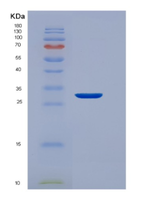 Recombinant Human EEF1D Protein,Recombinant Human EEF1D Protein