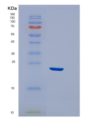 Recombinant Human EFNA3 Protein,Recombinant Human EFNA3 Protein