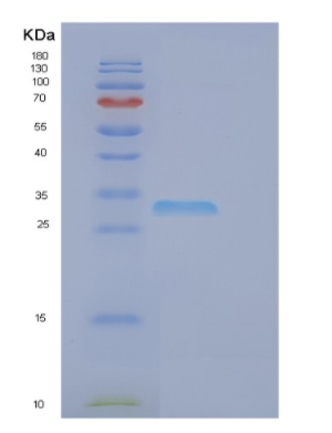 Recombinant Human EGLN3 Protein,Recombinant Human EGLN3 Protein