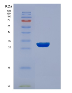 Recombinant Human EEF1B2 Protein,Recombinant Human EEF1B2 Protein