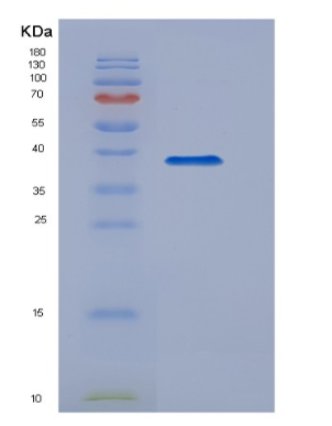 Recombinant Epidermal Growth Factor (EGF),Recombinant Epidermal Growth Factor (EGF)