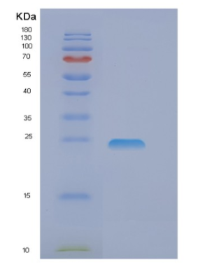 Recombinant Human EIF3J Protein,Recombinant Human EIF3J Protein
