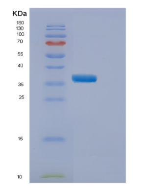 Recombinant Human ELP5 Protein,Recombinant Human ELP5 Protein