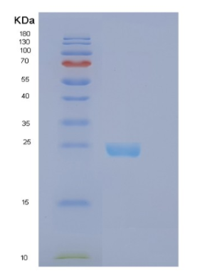 Recombinant Human EFNB2 Protein,Recombinant Human EFNB2 Protein