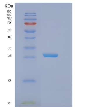 Recombinant Human EIF3K Protein,Recombinant Human EIF3K Protein