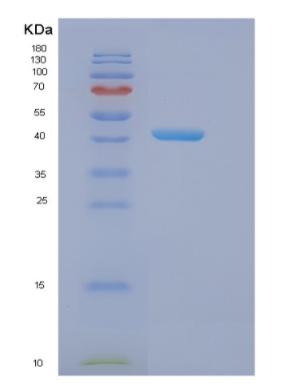 Recombinant Human EIF4A3 Protein,Recombinant Human EIF4A3 Protein