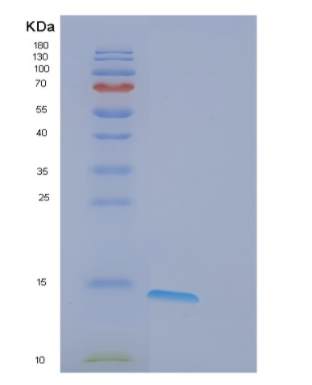 Recombinant Human eIF4E-BP1 Protein,Recombinant Human eIF4E-BP1 Protein