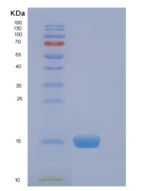 Recombinant Human EIF4EBP2 Protein,Recombinant Human EIF4EBP2 Protein