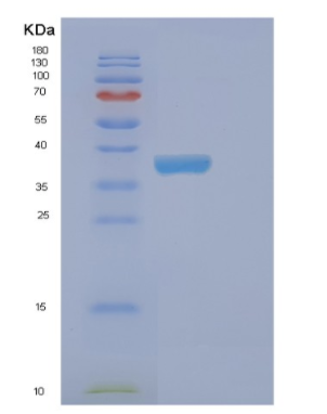 Recombinant Human EHF Protein,Recombinant Human EHF Protein