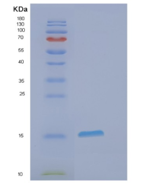 Recombinant Human EIF1 Protein,Recombinant Human EIF1 Protein