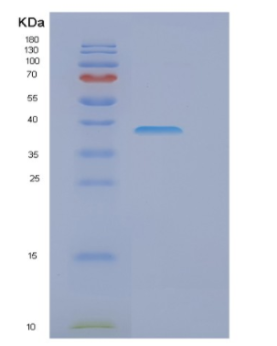 Recombinant Human EIF3I Protein,Recombinant Human EIF3I Protein