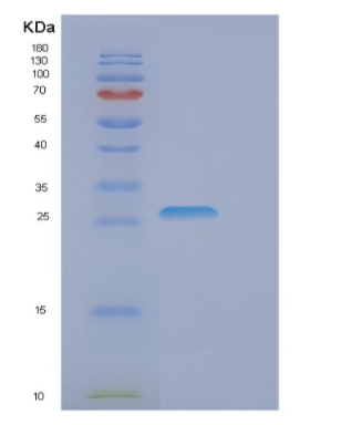 Recombinant Human EIF4E Protein,Recombinant Human EIF4E Protein