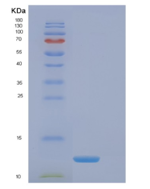 Recombinant Human EIF4EBP3 Protein,Recombinant Human EIF4EBP3 Protein