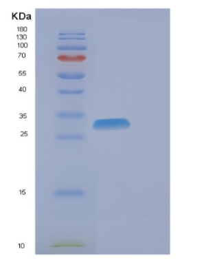 Recombinant Human EIF4H Protein,Recombinant Human EIF4H Protein