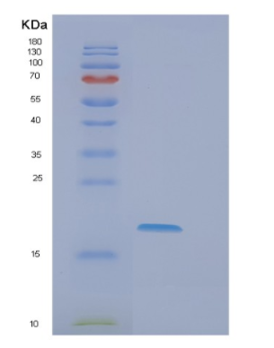 Recombinant Human EIF5A2 Protein,Recombinant Human EIF5A2 Protein