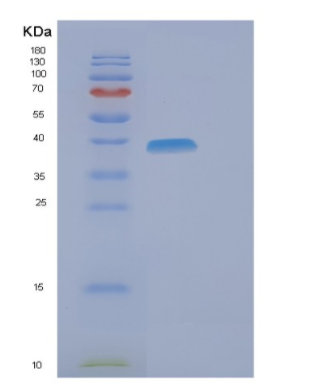 Recombinant Human ELAC1 Protein,Recombinant Human ELAC1 Protein