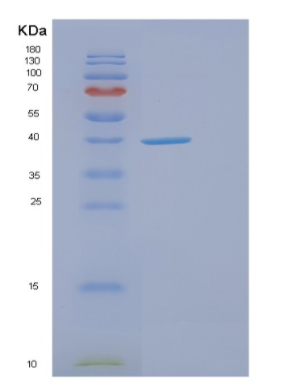 Recombinant Human ELAVL2 Protein,Recombinant Human ELAVL2 Protein