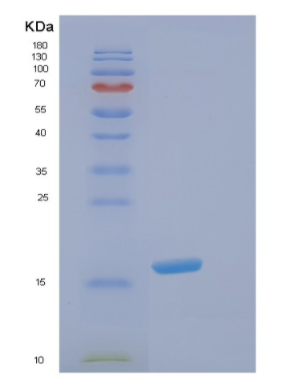 Recombinant Human elF5A Protein,Recombinant Human elF5A Protein