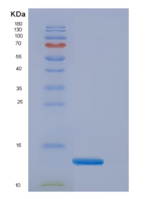 Recombinant Human Elongin B Protein,Recombinant Human Elongin B Protein