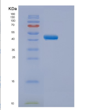 Recombinant Human ELP4 Protein,Recombinant Human ELP4 Protein