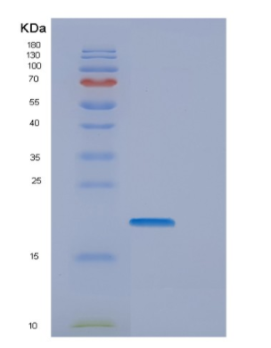 Recombinant Human EMCN Protein,Recombinant Human EMCN Protein