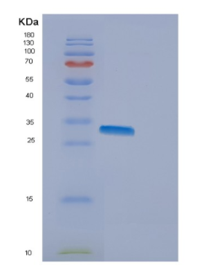 Recombinant Human EMG1 Protein,Recombinant Human EMG1 Protein