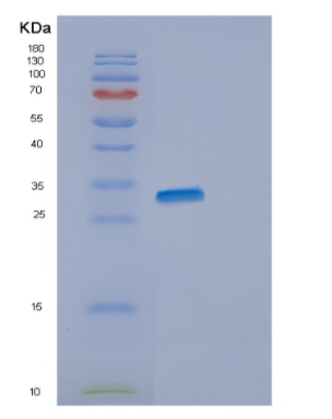 Recombinant Human ENOPH1 Protein,Recombinant Human ENOPH1 Protein