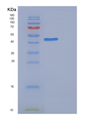 Recombinant Human EPHX1 Protein,Recombinant Human EPHX1 Protein