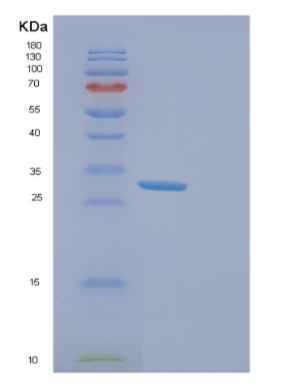 Recombinant Human ERCC1 Protein,Recombinant Human ERCC1 Protein