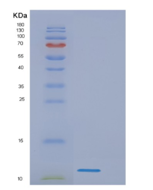 Recombinant Human Mycobacterium tuberculosis ESAT6 Protein,Recombinant Human Mycobacterium tuberculosis ESAT6 Protein