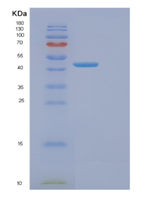 Recombinant Human ENO3 Protein,Recombinant Human TAU Protein