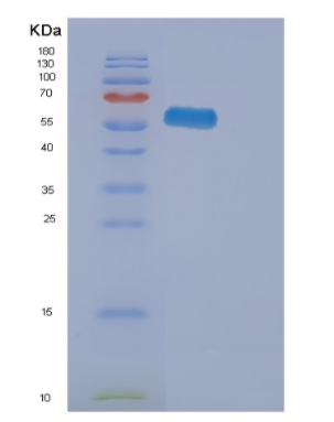 Recombinant Human EPHA2 Protein,Recombinant Human EPHA2 Protein