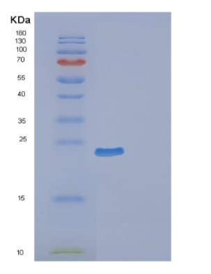 Recombinant Mouse Ephrin-B2 Protein,Recombinant Mouse Ephrin-B2 Protein