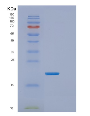 Recombinant Human ESM1 Protein,Recombinant Human ESM1 Protein