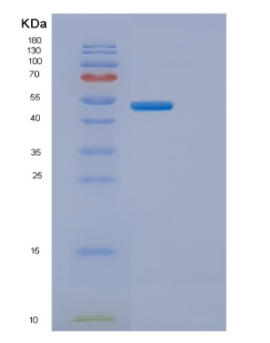 Recombinant Human ENTPD3 Protein,Recombinant Human ENTPD3 Protein